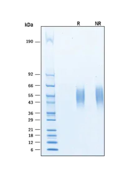 2 μg/lane Protein  was resolved with SDS-PAGE under reducing (R) and non-reducing (NR) conditions and visualized by Coomassie® Blue staining.